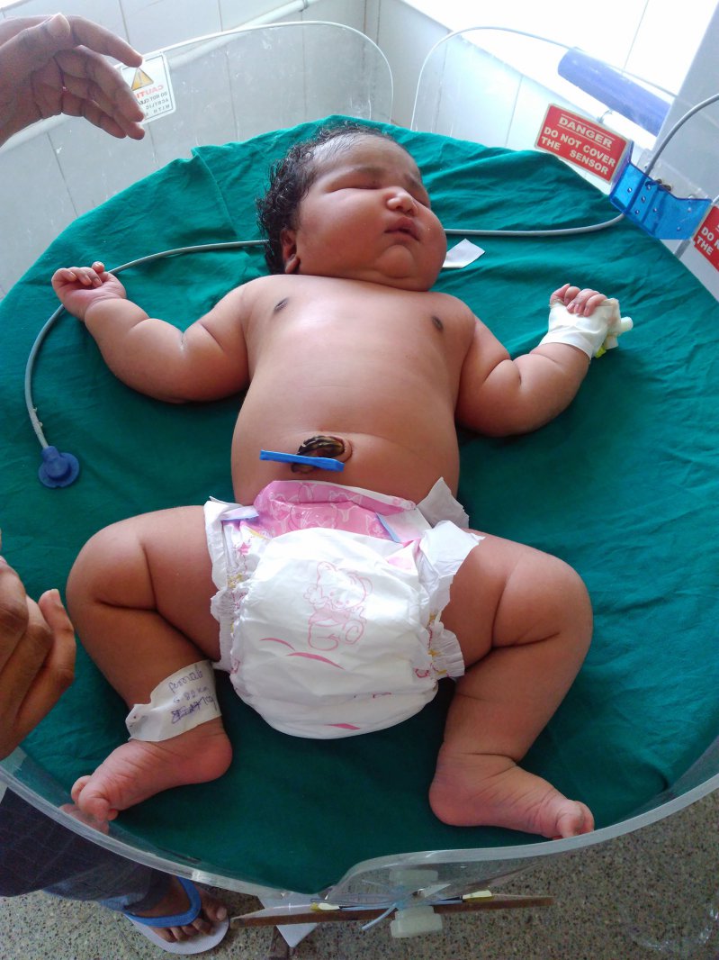 Nace en la India la bebé más grande del mundo  
