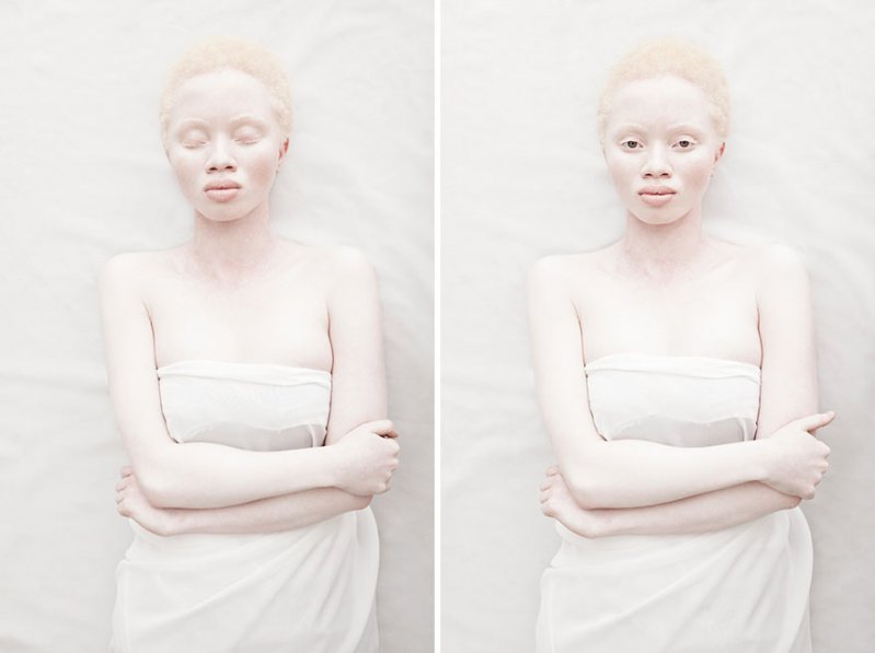 La belleza angelical de los albinos te dejará impactado   