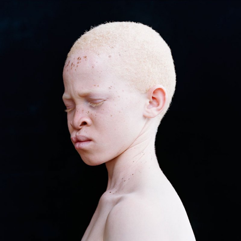 La belleza angelical de los albinos te dejará impactado   