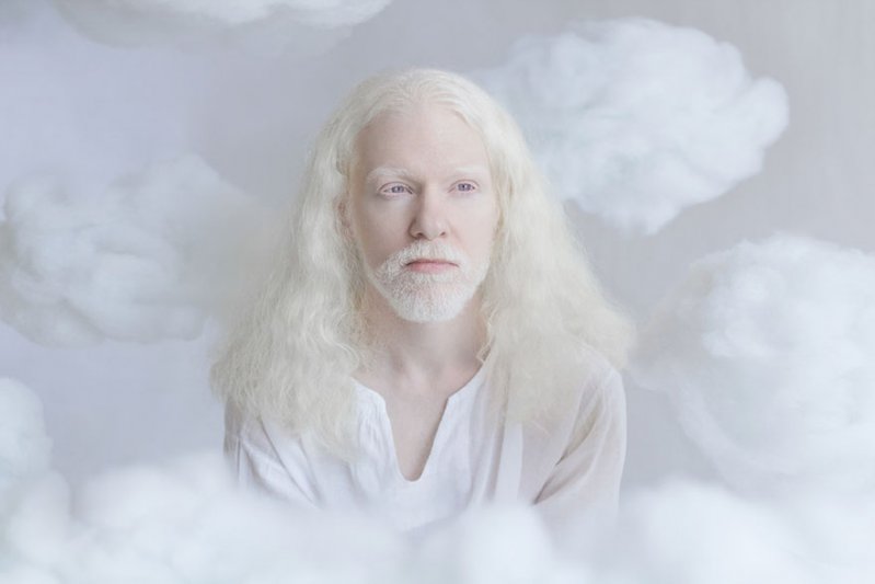 La belleza angelical de los albinos te dejará impactado   