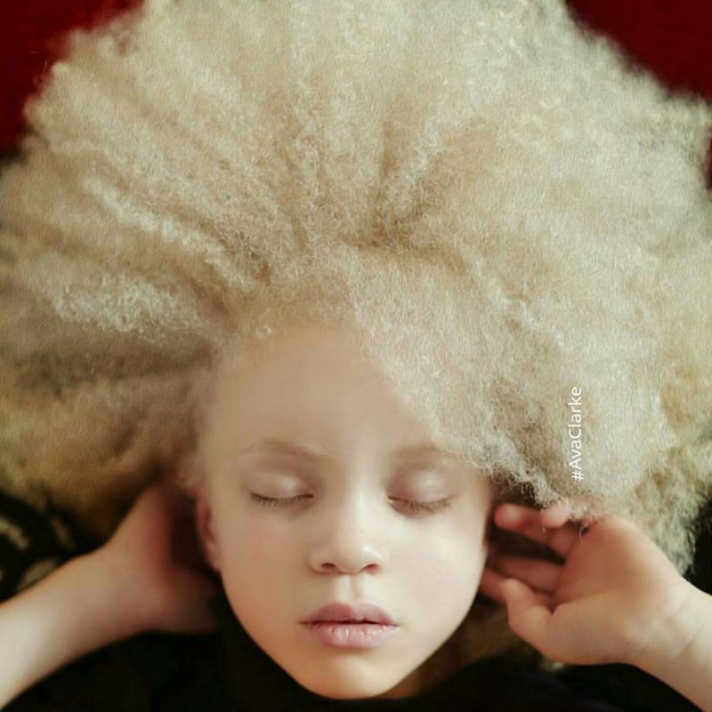 La belleza angelical de los albinos te dejará impactado   