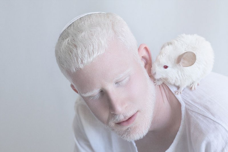 La belleza angelical de los albinos te dejará impactado   