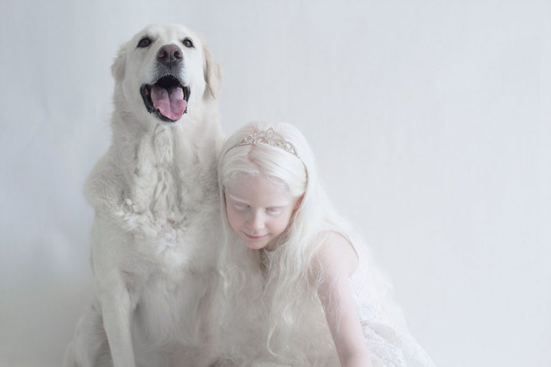 La belleza angelical de los albinos te dejará impactado   