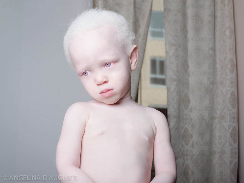 La belleza angelical de los albinos te dejará impactado   