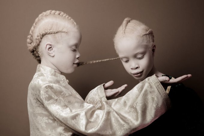 Estas gemelas albinas brasileñas están conquistando la industria de la moda con su belleza única 