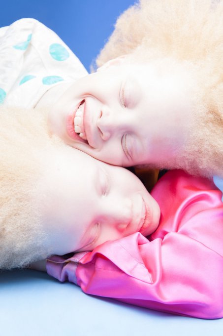 Estas gemelas albinas brasileñas están conquistando la industria de la moda con su belleza única 