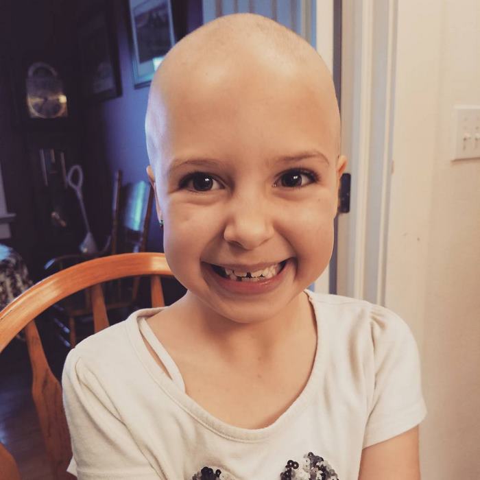 Esta niña de 7 años no permitió que su alopecia le impidiera deslumbrar en la escuela en el día de peinados locos 